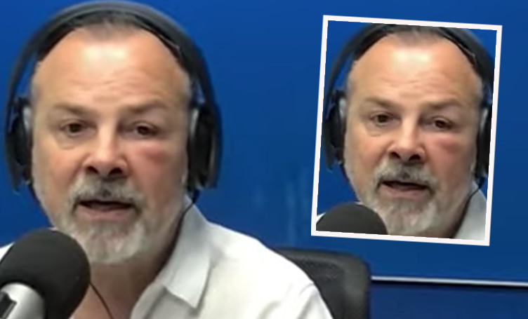 Imágenes sensibles! Gustavo Sylvestre apareció en la radio con la cara deformada: «Me agarró y me clavó el…»