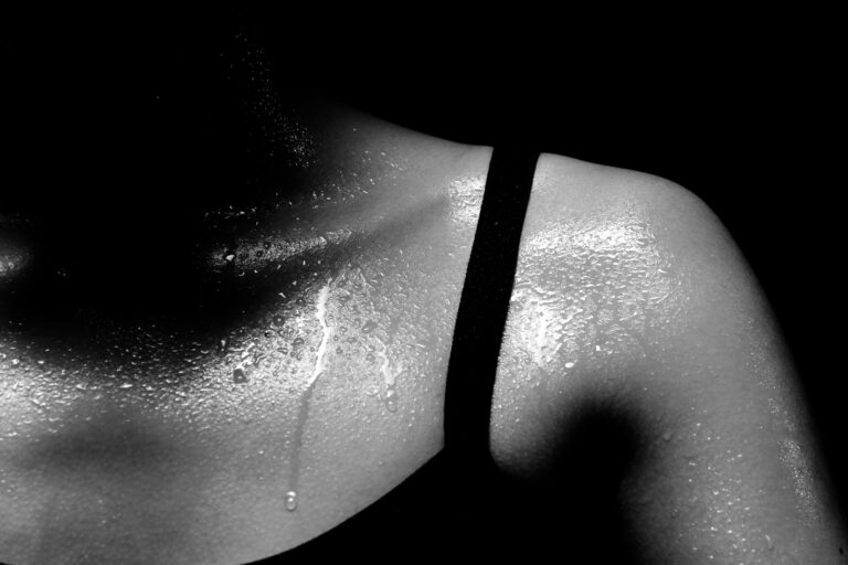 Ilustración médica que muestra las zonas del cuerpo comúnmente afectadas por la hiperhidrosis