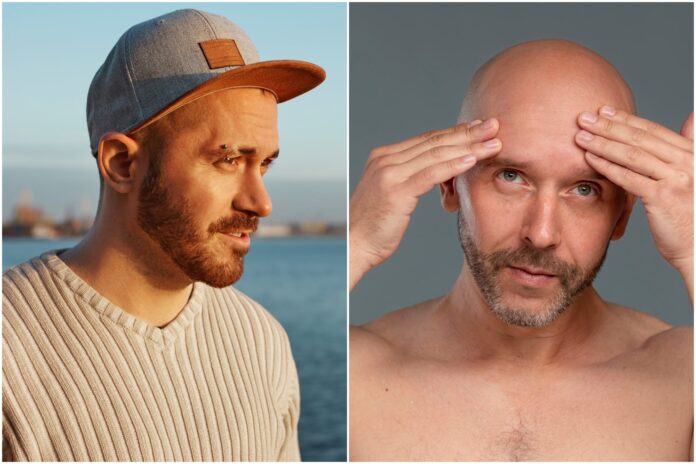 Persona sosteniendo una gorra, con un fondo que representa un estudio científico sobre el cabello.