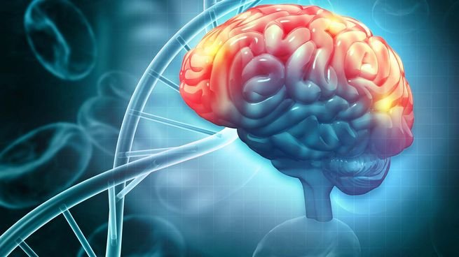 Representación de un accidente cerebrovascular hemorrágico en el cerebro