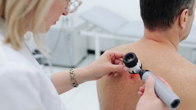 Dermatoscopio FotoFinder skeen prohibido por ANMAT