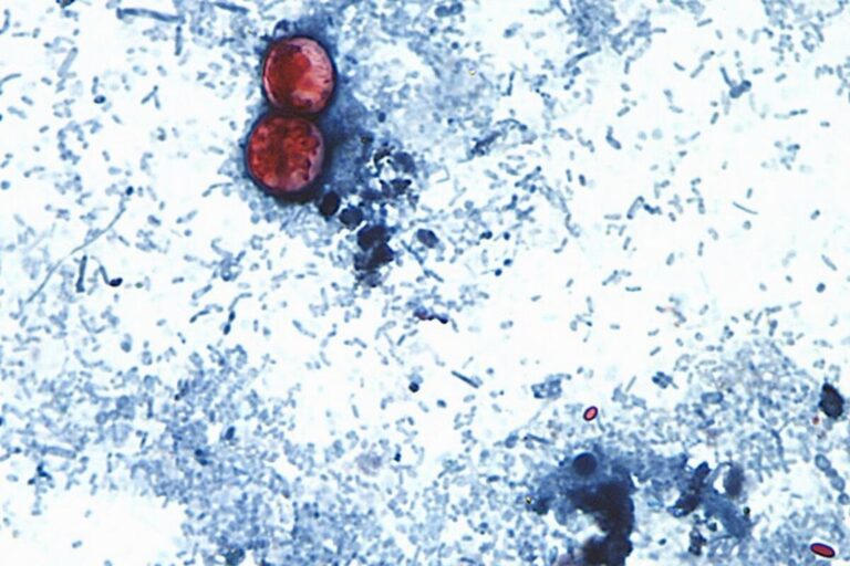 Imagen ilustrativa de verduras de hoja verde, posible fuente del brote de ciclosporiasis